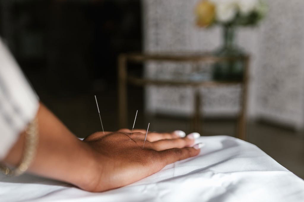 A person getting acupuncture treatment