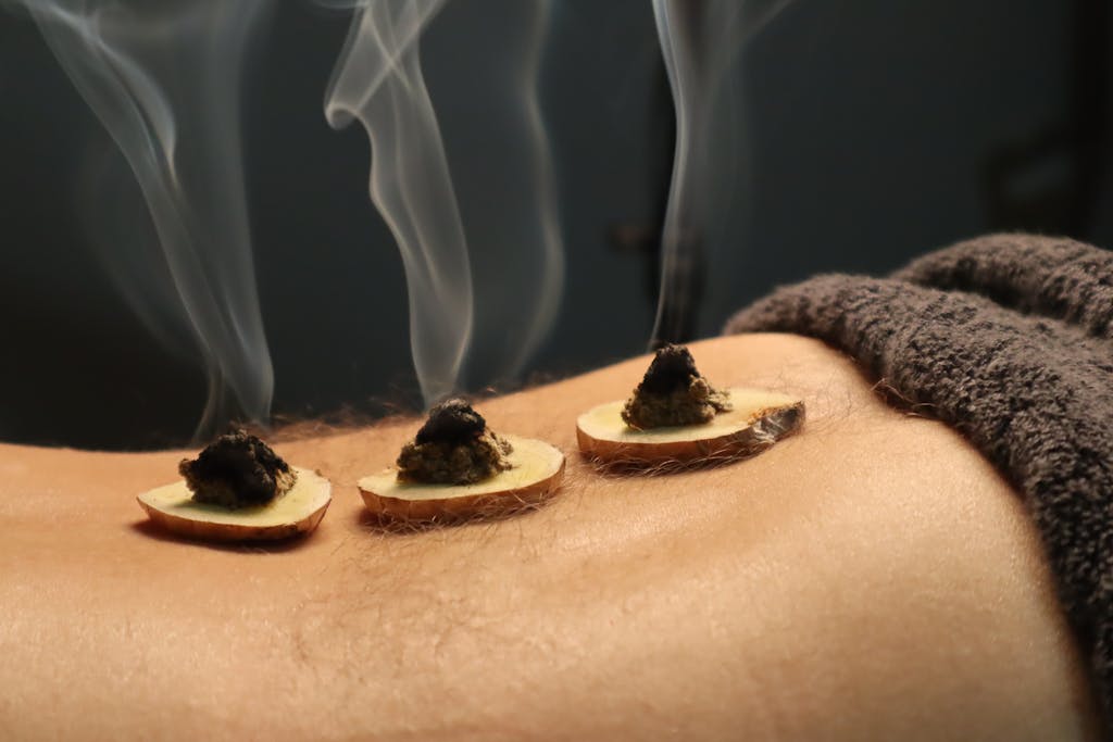 Burning moxa cone