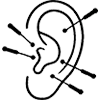 Auricular Acupuncture